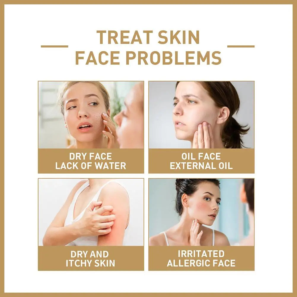 Rice Face Toner Moisturizing Water Brightening Lifting 150ml Deep Facial Cleanser For Young Glowy  Skin Care