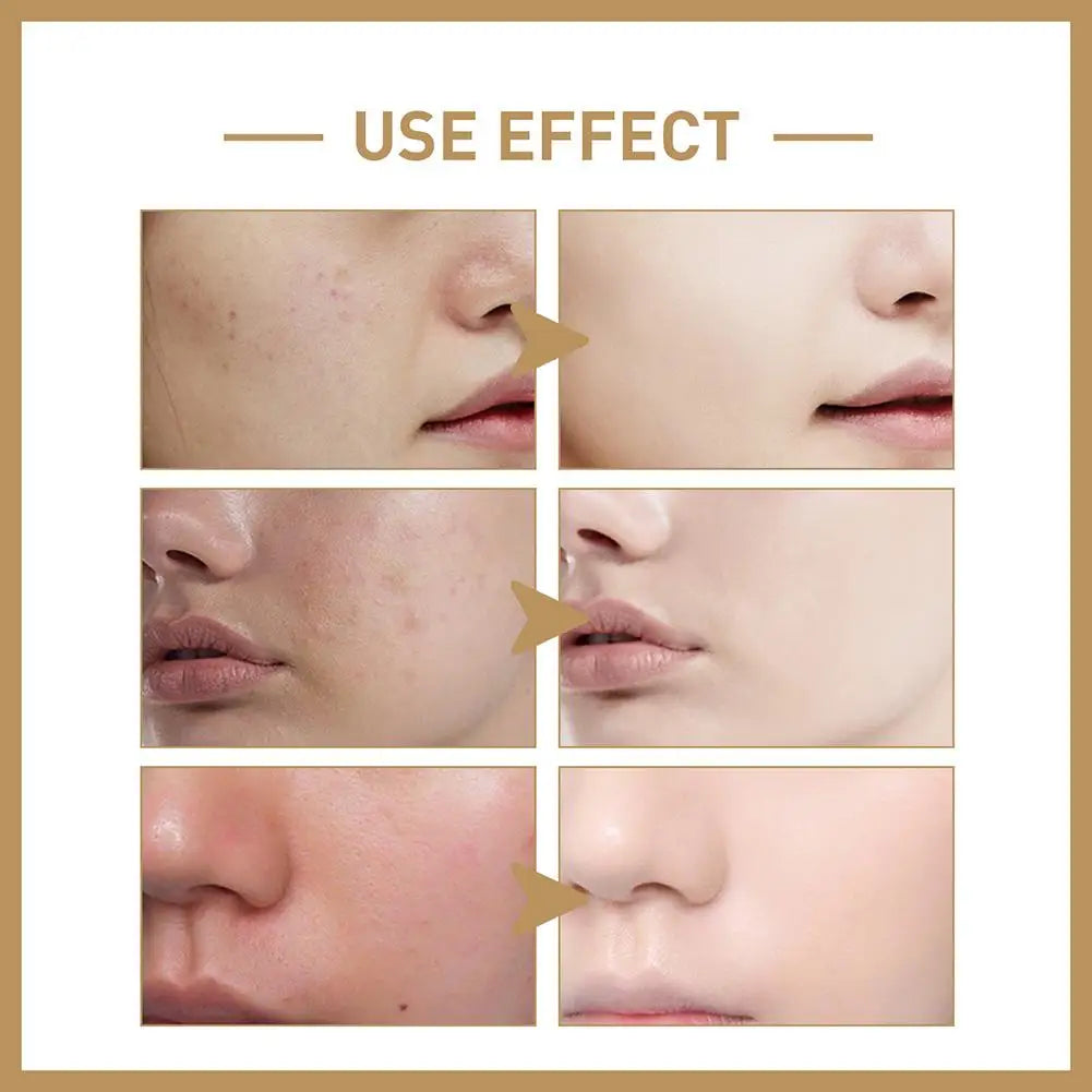 Rice Face Toner Moisturizing Water Brightening Lifting 150ml Deep Facial Cleanser For Young Glowy  Skin Care